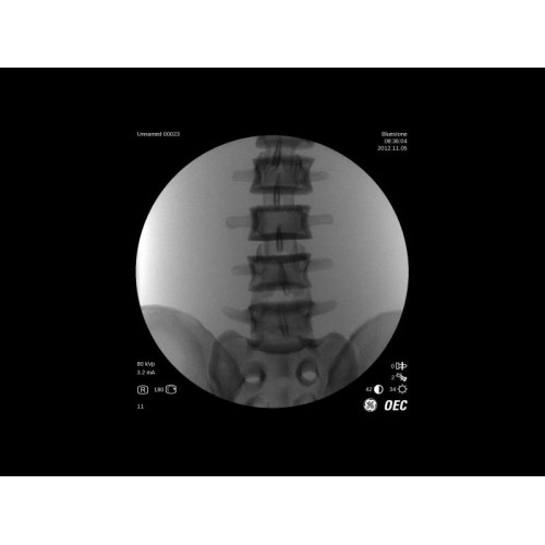 Моноблочный рентгенохирургический аппарат GE Brivo OEC 785/865