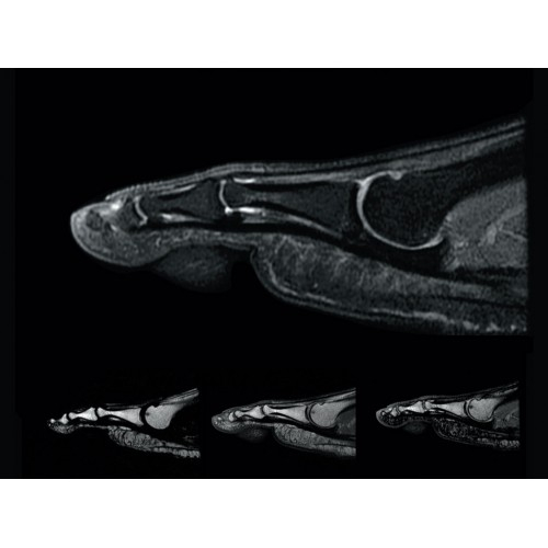 МРТ аппарат GE Optima MR450w 1.5T